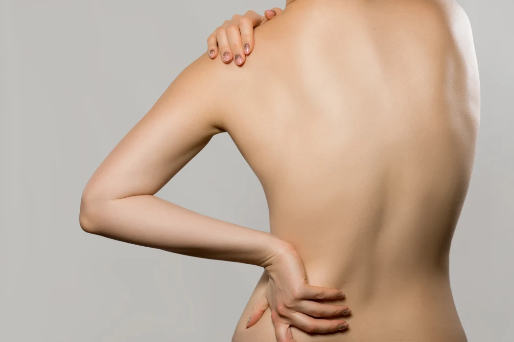 escoliosis